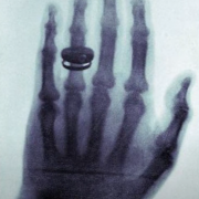 Wilhelm Conrad Röntgen, X-rays