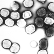 Vaiolo delle scimmie da Pixnio Foto di USCDCP da Pixnio https://pixnio.com/it/scienza/immagini-microscopio/vaiolo-vaccino-virioni-virione-singolo-completo-infettiva-virus-particelle#